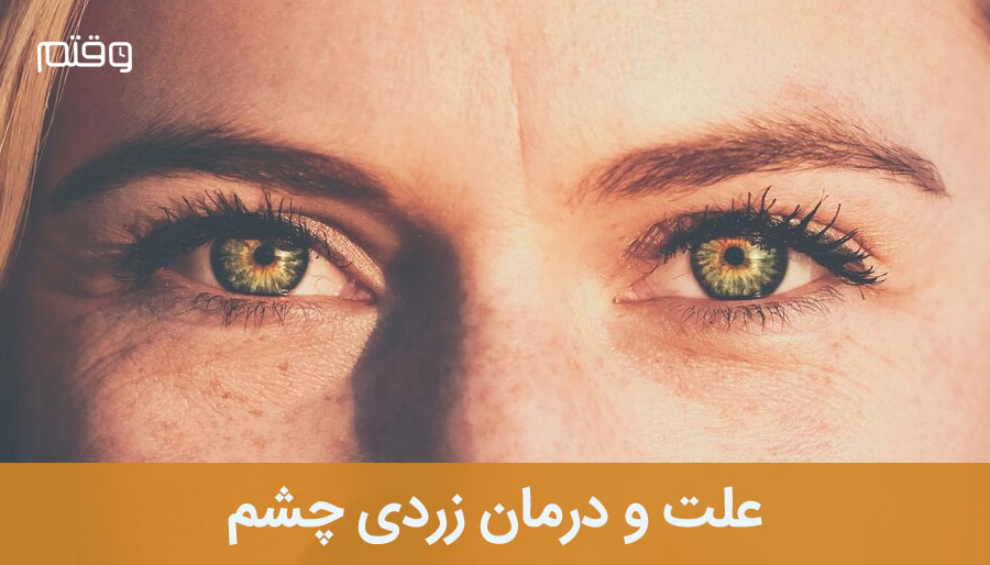 ⭕ آیا زردی چشم خطرناک است؟ چگونه درمان می شود؟